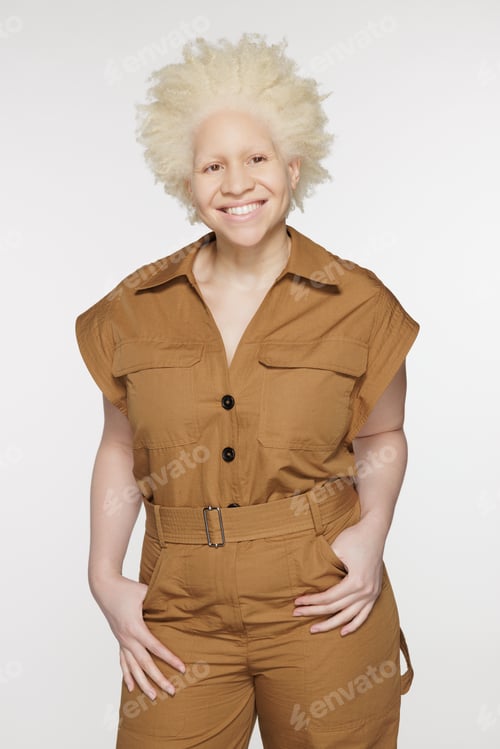 Preview: Three Quarter Length Shot Of Beautiful Black Non-Binary Person With Albinism In Their 20S Posing On