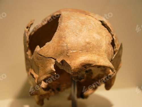 Preview: Bashed Skull Inside The Prokulus Church (Prokuluskirche) In Naturns, Province Of Bolzano