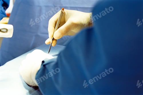 Preview: A Closeup Of Surgeon?S Hands In Rubber Gloves While Making An Incision With A Scalpel