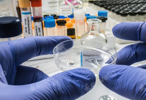 Preview: Nurse Examines Coronavirus Test On Petri Dish In Hospital, Concept Image