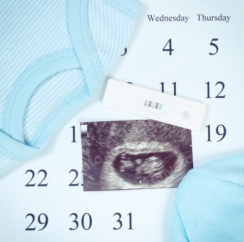 Preview: Vintage Photo, Pregnancy Test With Positive Result, Ultrasound Scan Of Baby And Clothing For