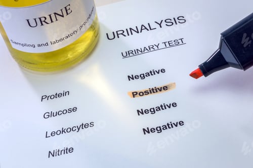 Preview: Tests For Research Of Urine