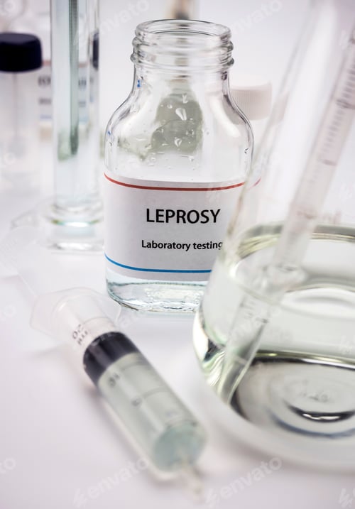 Preview: Test Leprosy In Laboratory, Conceptual Image, Vertical Composition
