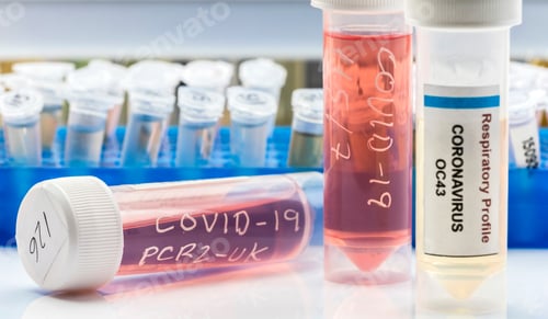 Preview: Vials With Samples Of Sars-Cov-2 Covid-19 In A Research Laboratory, Conceptual Image