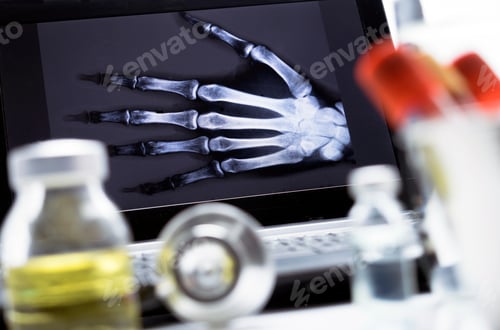 Preview: Hand Radiography In Hospital, Conceptual Image