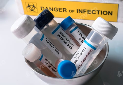 Preview: Respiratory Profile Pcr Vials For Patients Infected With Covid-19 Coronavirus In A Laboratory