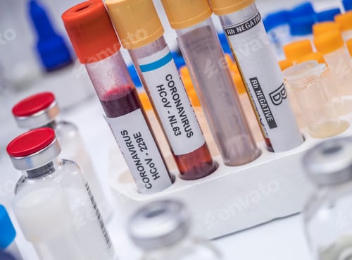 Preview: Coronavirus Sample In Laboratory, Concept Image