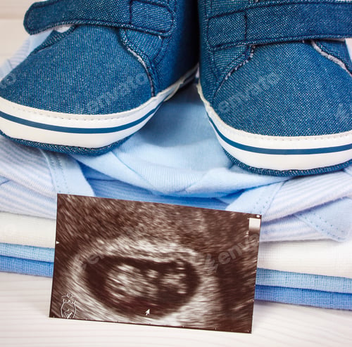 Preview: Ultrasound Scan Of Baby And Clothing For Newborn On Boards, Concept Of Extending Family And