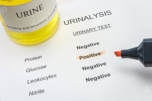 Preview: Tests For Research Of Urine
