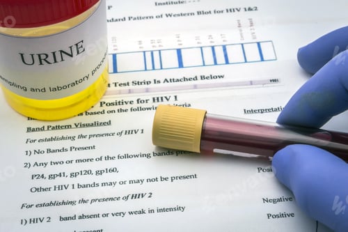 Preview: Tests For Research Of Urine