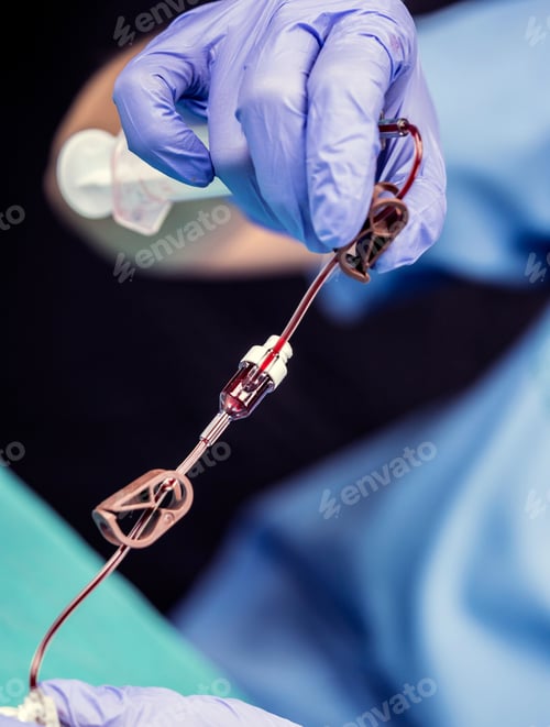 Preview: Nurse Prepares Venous Catheters Of Long Duration In A Hospital, Accessing Indwelling Central Venous