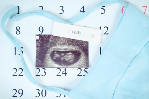 Preview: Vintage Photo, Pregnancy Test With Positive Result, Ultrasound Scan Of Baby And Clothing For