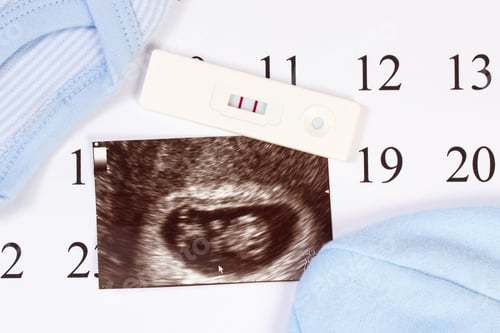 Preview: Pregnancy Test With Positive Result, Ultrasound Scan Of Baby And Clothing For Newborn On Calendar