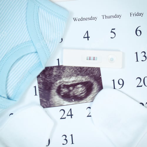 Preview: Vintage Photo, Pregnancy Test With Positive Result, Ultrasound Scan Of Baby And Clothing For
