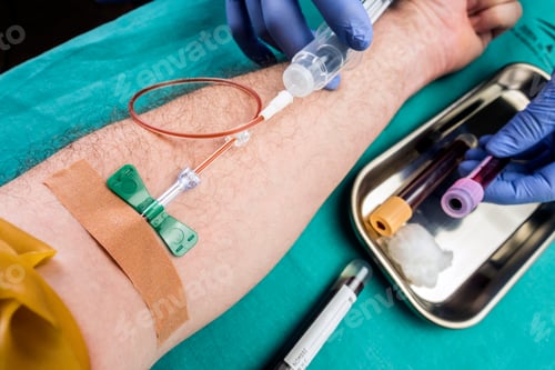 Preview: Nurse Draws Blood To A Blood Donor In A Hospital, Conceptual Image