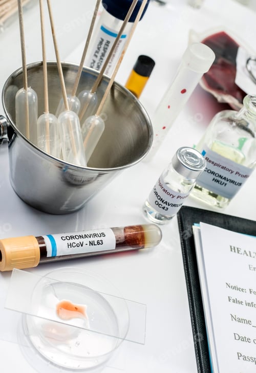 Preview: Coronavirus Sample In Laboratory, Concept Image