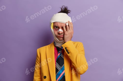 Preview: Sullen Unhappy Adult Man Hides His Bruised Face After Got Into Car Aacident, Beaten By Robbers