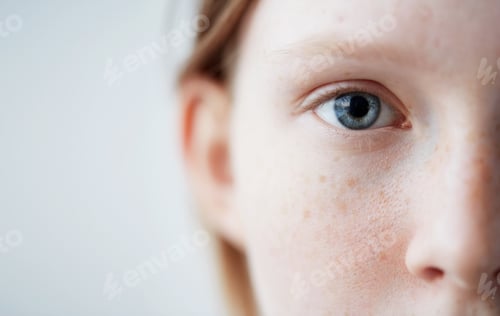 Preview: Young Eyes Girl Beautiful Redhead Freckles Woman Face Closeup Portrait With Healthy Skin