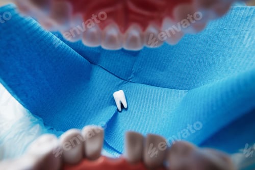 Preview: Tooth Fell Out At Dentist Office. Point Of View Of The Patient.