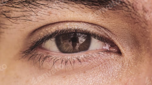 Preview: Close Up Of An Eye