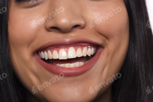Preview: Close Up Of Young Beautiful Woman With White Healthy Teeth Smiling.