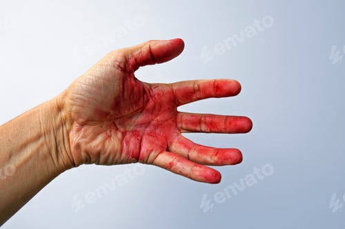 Preview: Male Hand Covered In Blood