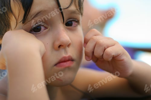 Preview: Boy With Sad Look After Hurting His Chin, Narrow Focus