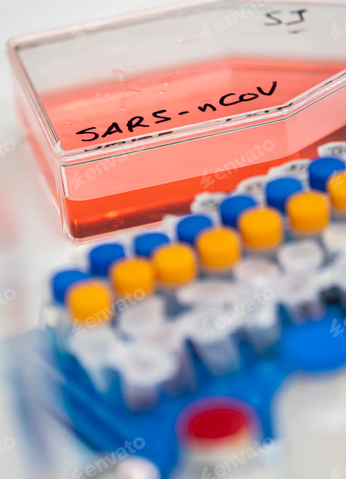 Preview: Vials with samples of SARS-COV-2 Covid-19 prepared cold in a hospital, conceptual image
