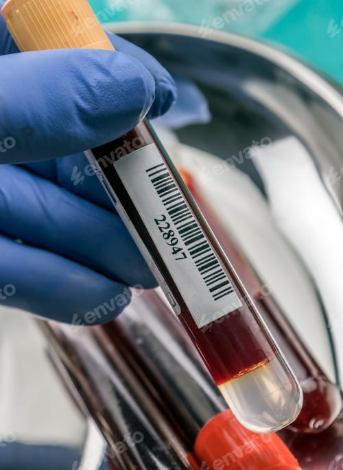 Preview: Doctor holds blood sample at a hospital table, conceptual image