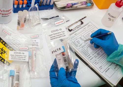 Preview: Nurse analyses positive PCR tests of covid-19 in a hospital laboratory, conceptual image