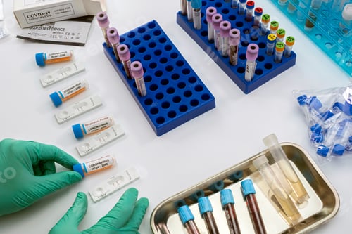 Preview: Nurse analyses positive PCR tests of covid-19 in a hospital laboratory, conceptual image