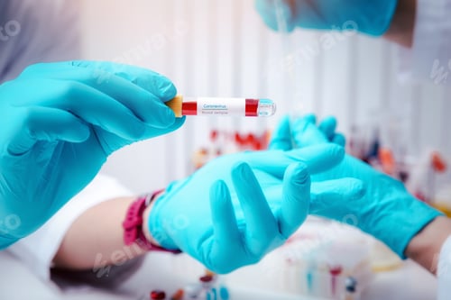 Preview: Researchers test blood samples in the laboratory.