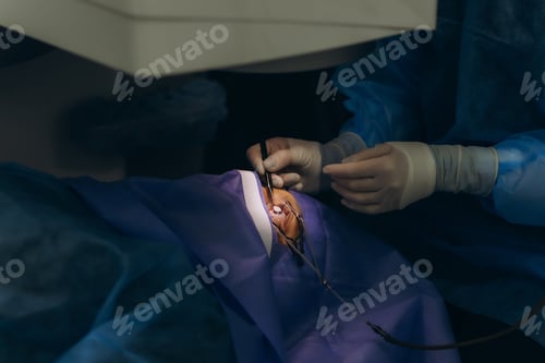 Preview: Surgeon performing lasik eye surgery for vision correction