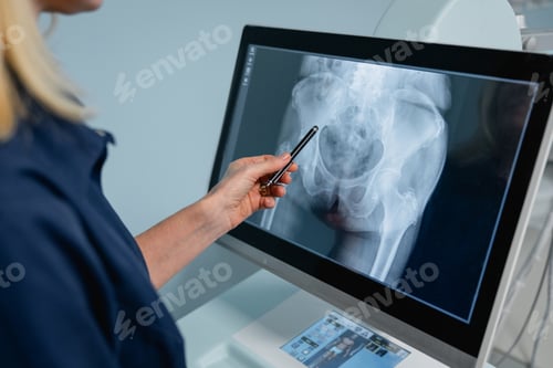 Preview: Woman doctor reviewing X-ray results on equipment monitor in clinic