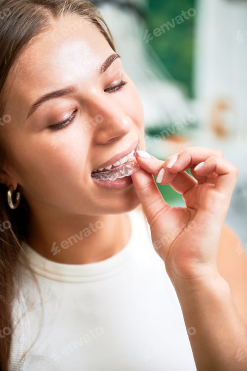 Preview: Young woman removes clear aligner from teeth in close up. Daily orthodontic routine