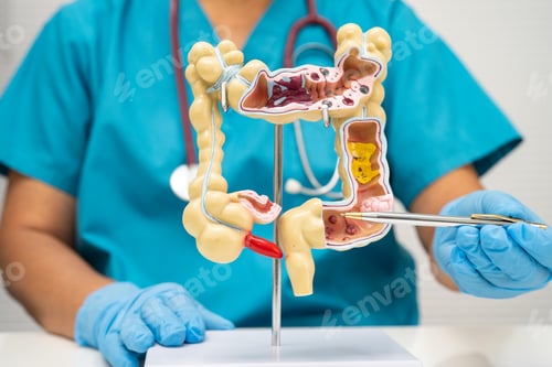 Preview: Intestine, doctor holding human anatomy model for study diagnosis and treatment in hospital.