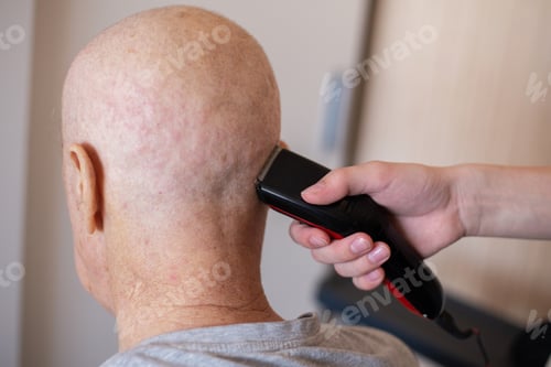 Preview: Hair clippers shaving bald head during cancer treatment