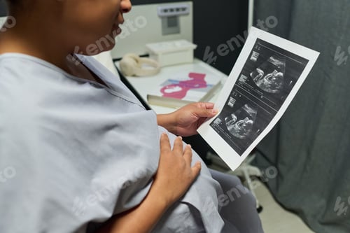 Preview: Midsection of Pregnant Woman Holding Ultrasound Scan during Prenatal Checkup