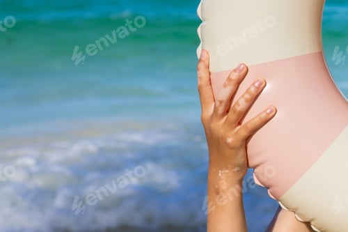 Preview: Hand holding inflatable at a beach. White vitiligo spot on finger