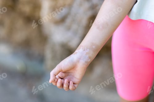 Preview: Close up clenched fist strength gesture outdoors for motivation