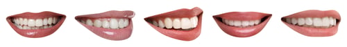 Preview: Collage with smiles of different people on white background. Dental care for teeth health