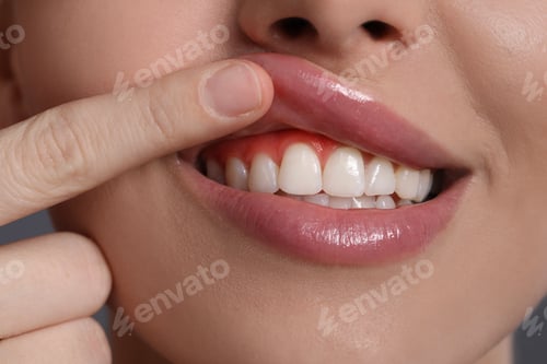 Preview: Woman showing inflamed gum, closeup. Oral health
