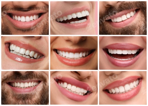Preview: Smiling men and women, collage of closeup photos