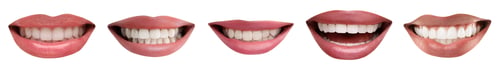 Preview: Collage with smiles of different people on white background. Dental care for teeth health
