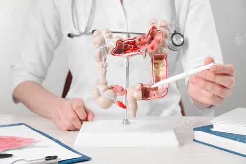 Preview: Doctor showing model of large intestine at table, closeup