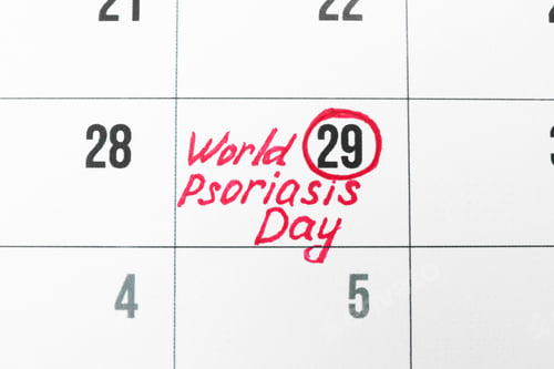 Preview: International Psoriasis Day. Calendar page with marked date as background, top view