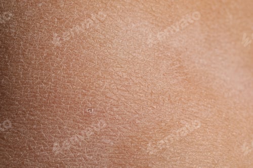 Preview: Texture of dry skin as background, closeup