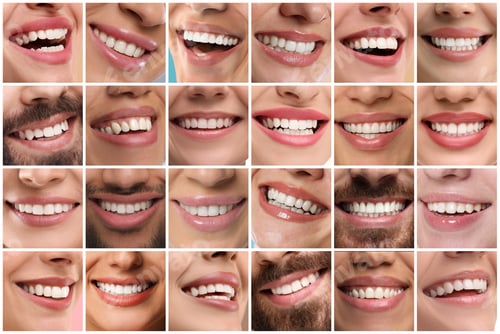 Preview: Smiling men and women, collage of closeup photos