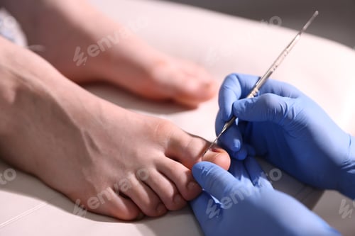 Preview: Podiatrist examining client's nail bed on foot with chisel tool indoors, closeup