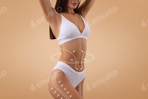 Preview: Liposuction. Woman with perfect figure against dark beige background, closeup. Markings on her body